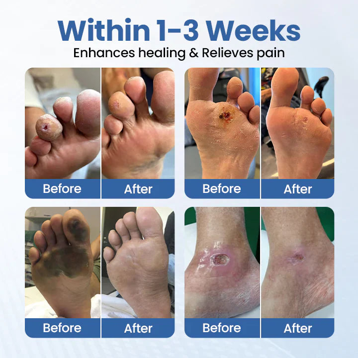 DarkFairy VitaGluco Diabetes Treatment Cream