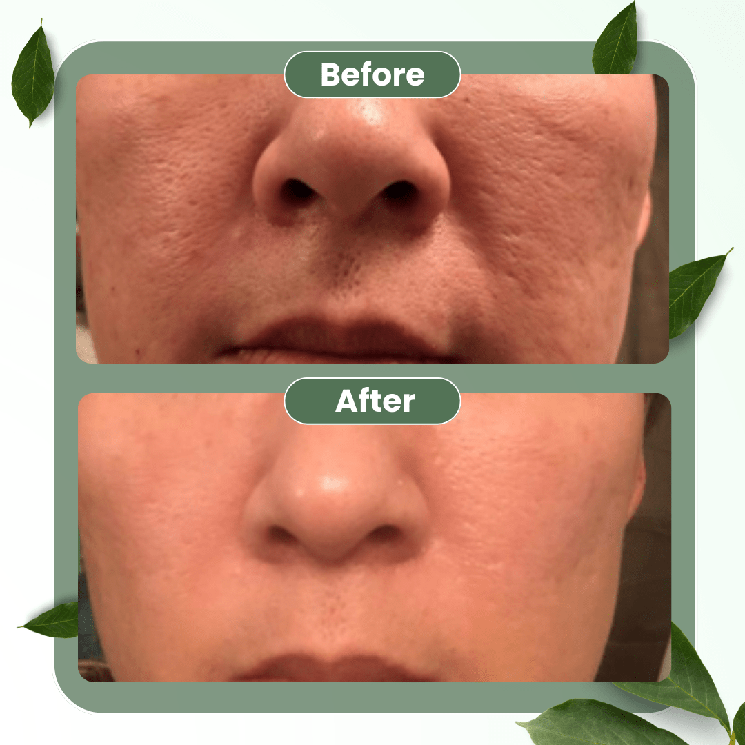 (⏰𝐋𝐢𝐦𝐢𝐭𝐞𝐝 𝐭𝐢𝐦𝐞 𝐝𝐢𝐬𝐜𝐨𝐮𝐧𝐭 𝐋𝐚𝐬𝐭 𝟑𝟎 𝐦𝐢𝐧𝐮𝐭𝐞𝐬⏰) DarkFairy Green Tea Deep Cleanse Mask Stick ACE 1