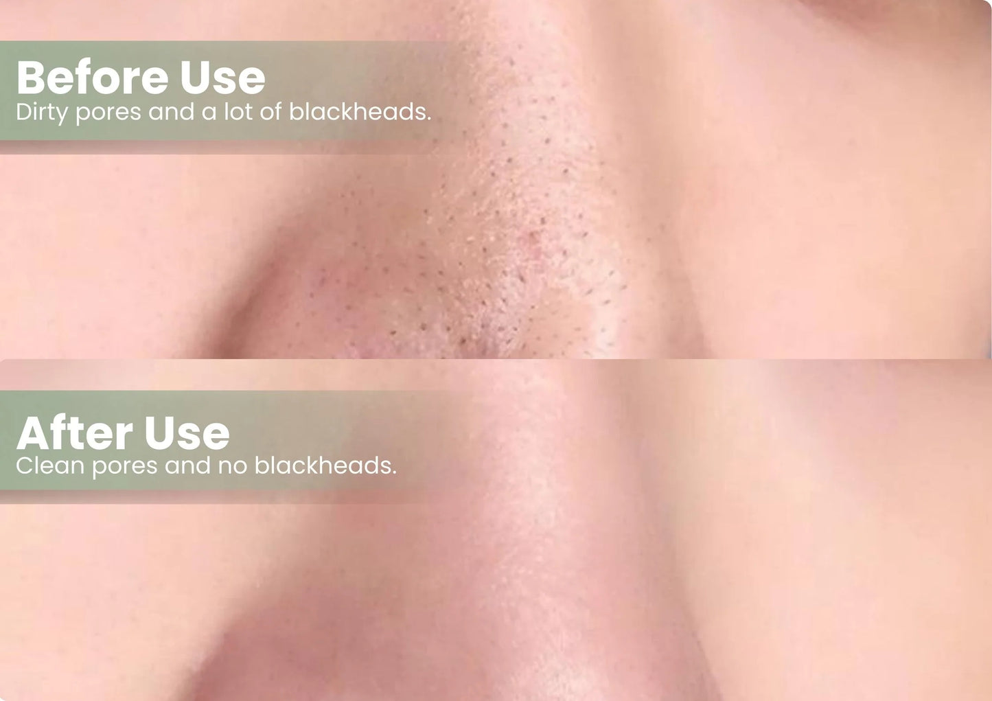 (⏰𝐋𝐢𝐦𝐢𝐭𝐞𝐝 𝐭𝐢𝐦𝐞 𝐝𝐢𝐬𝐜𝐨𝐮𝐧𝐭 𝐋𝐚𝐬𝐭 𝟑𝟎 𝐦𝐢𝐧𝐮𝐭𝐞𝐬⏰) DarkFairy Green Tea Deep Cleanse Mask Stick ACE 1