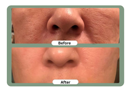 (⏰𝐋𝐢𝐦𝐢𝐭𝐞𝐝 𝐭𝐢𝐦𝐞 𝐝𝐢𝐬𝐜𝐨𝐮𝐧𝐭 𝐋𝐚𝐬𝐭 𝟑𝟎 𝐦𝐢𝐧𝐮𝐭𝐞𝐬⏰) DarkFairy Green Tea Deep Cleanse Mask Stick ACE 1